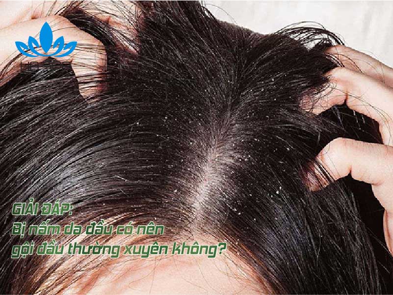 avt bi nam da dau co nen goi dau thuong xuyen khong